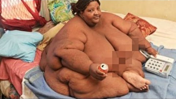 Tolstye Lyudi Vynuzhdeny Pryatatsya Istoriya Kaliningradskogo Studenta Mechtayushego Pohudet Novosti Kaliningrada