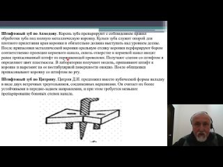 Простое зубопротезирование. Методы восстановления дефектов коронок зубов штифтовыми конструкциями