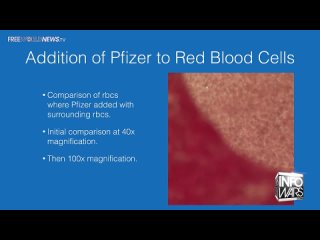 Medical Bombshell: Pfizer Vax Attacks Human Blood Creating Clots Under Microscope