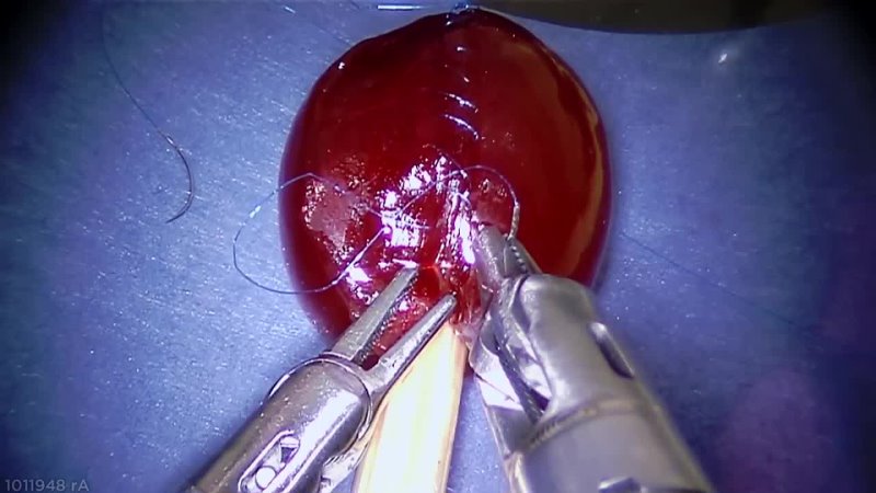 Робот хирург Да Винчи зашивает виноградинку