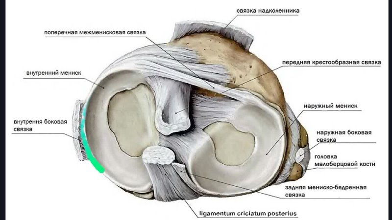 Структурные изменения мениска. Структура мениска коленного сустава. Медиальный мениск коленного сустава анатомия. Задняя мениско бедренная связка. Анатомия латерального мениска коленного сустава.