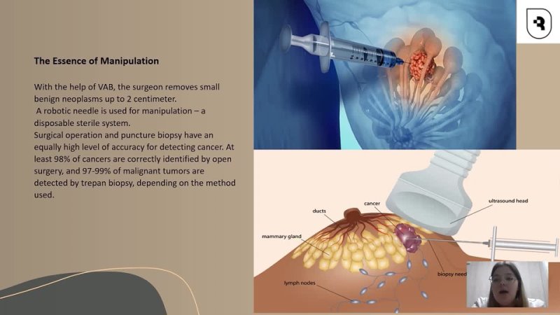 VACUUM ASPIRATION BIOPSY OF MAMMARY