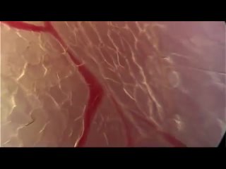 Остеопатия - удивительное видео