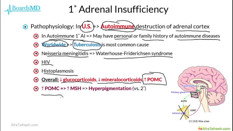 Adrenal 1 ( Adrenal Insufficiency Pres Path)
