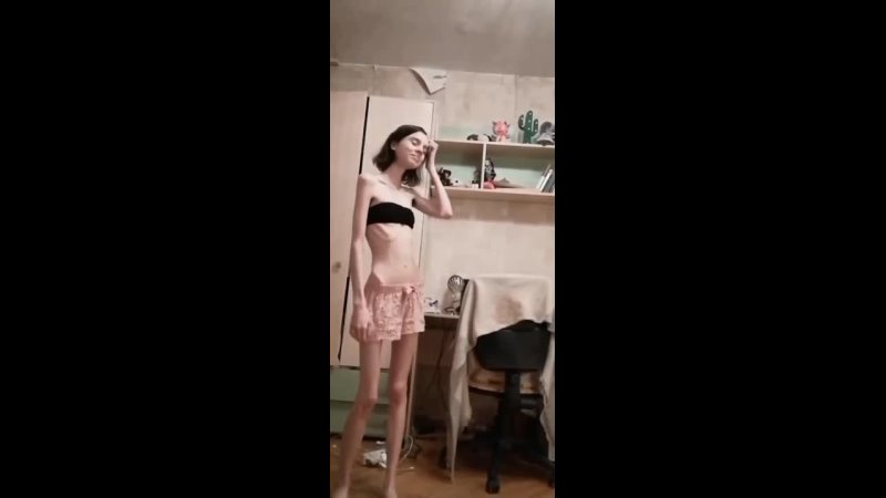 Anorexic girl
