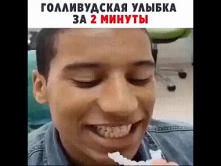 Snap On Smile съемные виниры