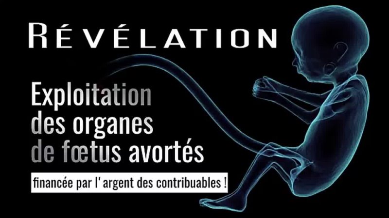Exploitation des organes de fœtus avortés