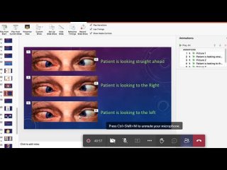 ST5.54 year old man with diplopia