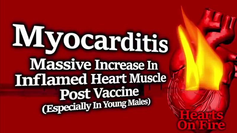 HEARTS IN FLAMES: NUMEROUS MYOCARDITIS STUDIES SHOWING EXTREME RISK FOR YOUNG