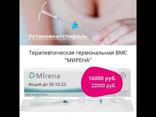 Установка внутриматочной гормональной спирали в Централ Клиник Воронеж .mp4