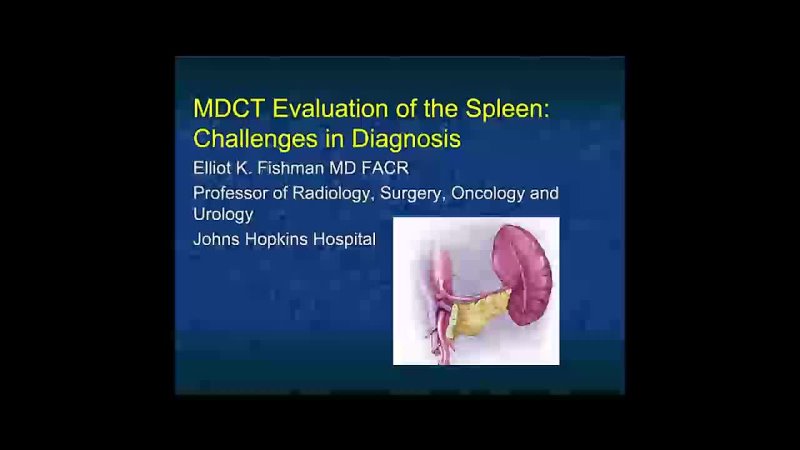MDCT Evaluation of the