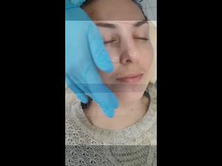 Биоревитализирующий пилинг + маска анти-эйдж