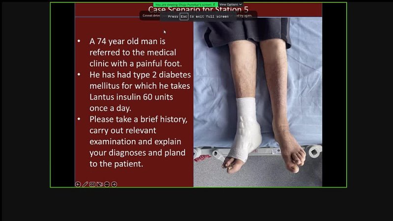 year old diabetic man with right foot pain