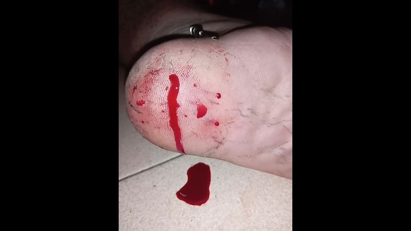 needle heel torture