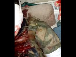 Раненный боец ЮВО разведывательной штурмовой бригады в районе Бахмута (Артёмовск)