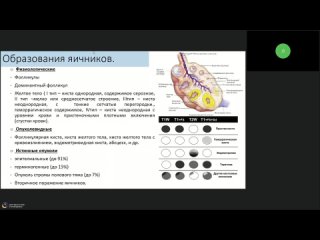 Применение системы O-RADS в МРТ для дифференциальной диагностики образований яичников на примере клинических наблюдений