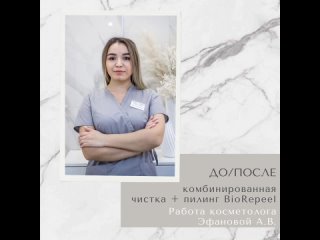 ДО/ПОСЛЕ