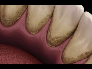 Видео от Медицинский центр и Стоматология  “Лор Дент“