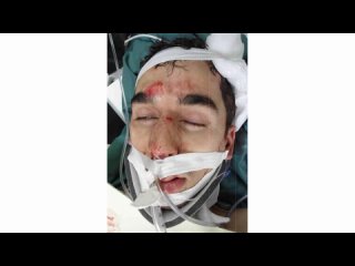 The Communist Showan Shattak was beaten so his skull cracked