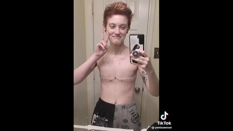 Trans-Terror: Lustiges Brüste-Amputieren