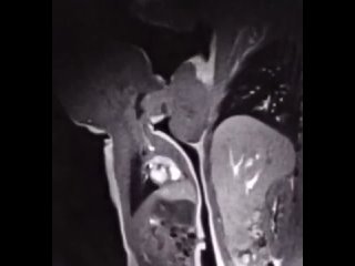 This is what breastfeeding looks like in MRI