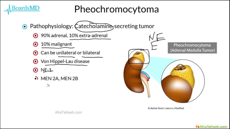 Adrenal 3 ( Adrenal Crisis, Pheochromocytoma)