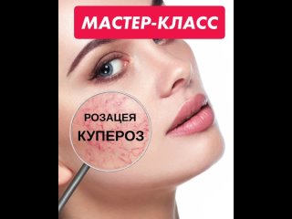 Мастер класс купероз/розацея