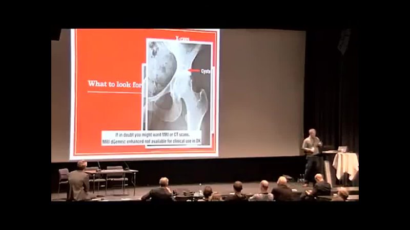 Painful hip in young adults - Sports Medicine Congress 2016