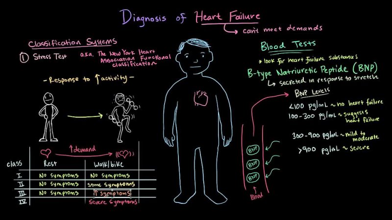 [khanacademymedicine] Heart failure diagnosis | Circulatory System and Disease | NCLEX-RN | Khan Academy