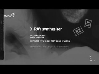 X-ray sound of bones  ArtTECH NUST MISIS