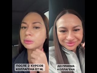 Video by Хиропластический массаж лица/ Melissa/ Глазов