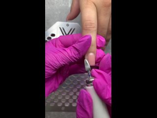 Поднятие клюющих ногтей с помощью геля средней вязкости