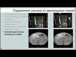 Артефакты и способы борьбы с ними