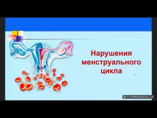 АиГ. Лекция №2. Нарушения менструального цикла. Аномальные маточные кровотечения