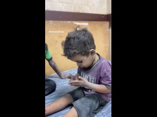 🇵🇸  IMÁGENES QUE PARTEN EL ALMA: Este niño Palestino aterrorizado, tiembla de miedo tras ser herido por un bombardeo israelí en