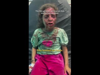 “¡No veo nada!”... Una niña pequeña perdió la vista por las heridas causadas por un bombardeo sionista que destruyó su casa en J