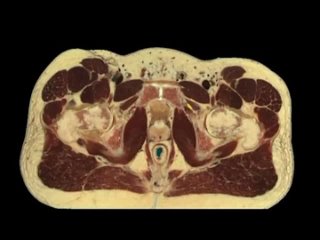 Топографическая анатомия бедренного нерва