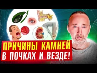 Отчего образуются камни и кальций в Почках? Как очистить Почки и Сосуды?