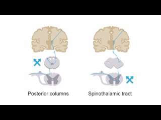 Clinical Neurology Essentials  by tracts and levels