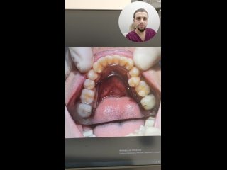 Видео от Стоматология Елены Ведерниковой