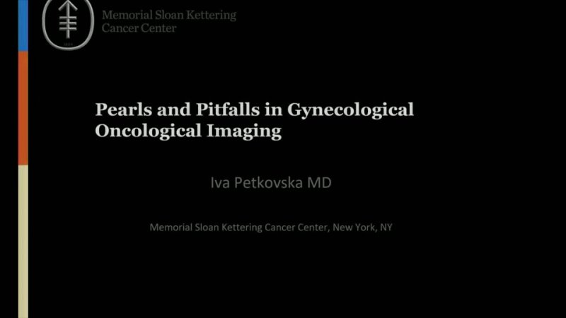 87. Pearls   Pitfalls in Gynecological Oncological Imaging