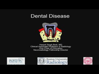 102. Dental Disease