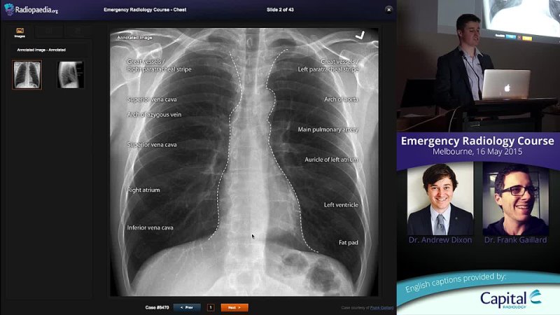 16 Chest emergencies Andrew