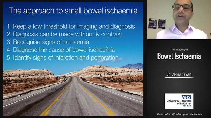 35 Bowel ischemia Vikas