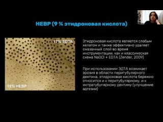 Video by UC_STOM_DENTAL | Стоматология