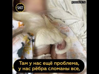 Матери, которая сломала кости малышу в Подмосковье, грозит до трёх лет тюрьмы.   Против 24-летней де