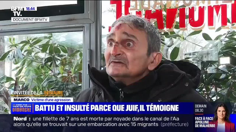 Gaza/Israël -  Marco, Juif, 62 ans, a été agressé vendredi 1er mars 2024 dans le 20e arrondissement de Paris