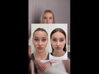 Видео от Клиника косметологии Miss Magnet