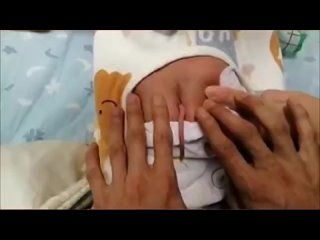 Уникальный ребенок с 10-сантиметровым хвостом родился в Китае