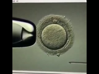 Искусственное оплодотворение яйцеклетки